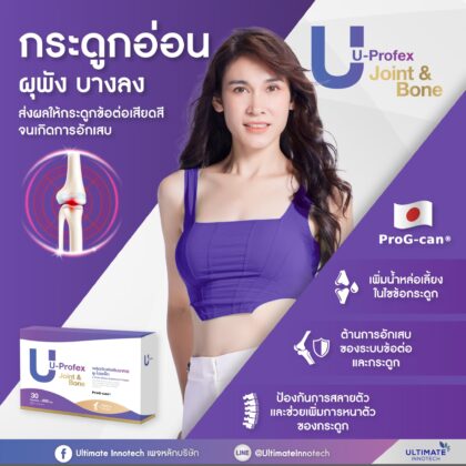 U-Profex — ดูแลข้อต่อ