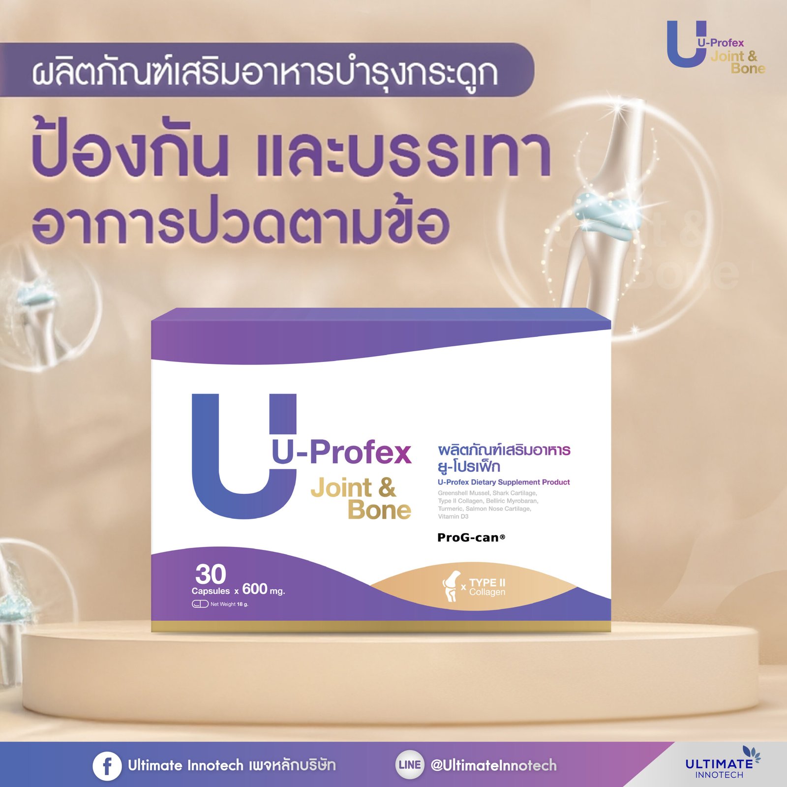 U-Profex product overview